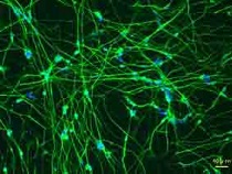 iPS細胞から誘導した神経細胞